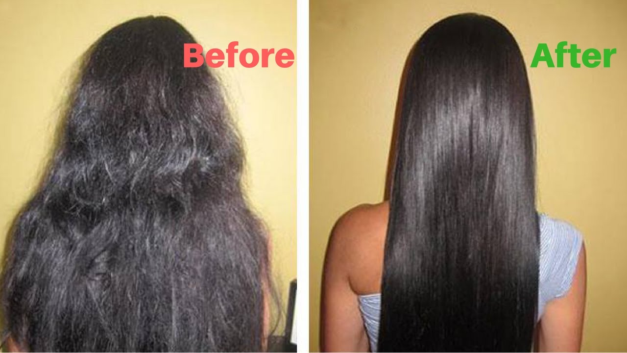 Dry Scalp and Hair Fall Causes Symptoms Home Remedies and Diet to  Prevent Scalp Dryness by Expert in Hindi  डरई सकलप सर क रखपन क  करण और दर करन क घरल