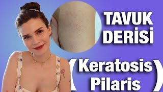 Tavuk derisi Görüntüsünden Kurtulmanın Püf Noktaları | Keratosis Pilaris