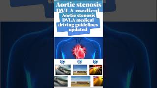 DVLA Medical Driving Updated Guidelines – Aortic Stenosis (2025)
