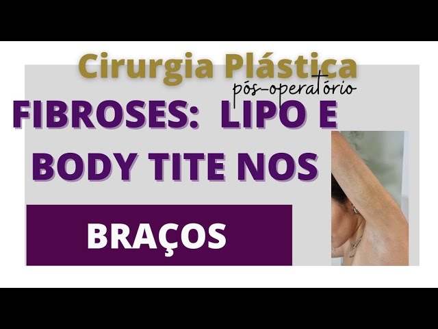 Lipo de definição - Expectativa × Resultados. Por que elas não gostaram ? 