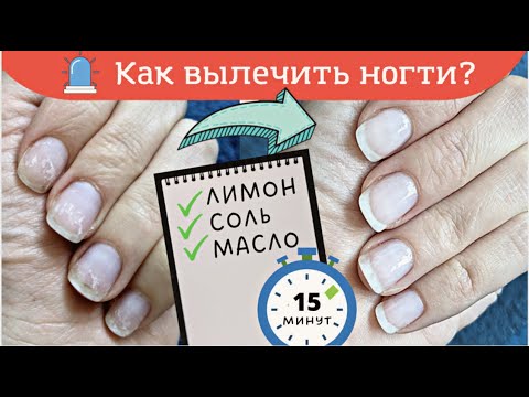 Как вылечить ногти после гель лака в Домашних условиях? - Только народные средства!