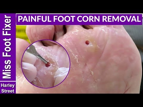 What Do Pumice Stones Work For Hair Removal