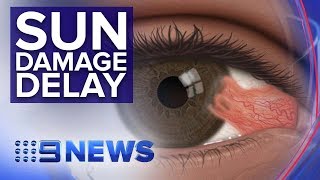 New drops could delay surgery for ‘Surfer’s Eye’ condition | Nine News Australia