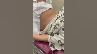 Tummy deflation when the baby out😱