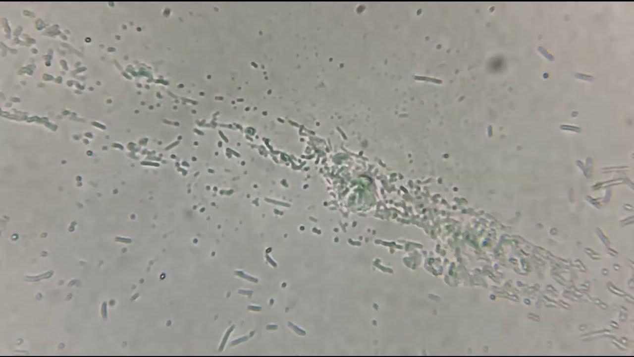 Dental plaque under a microscope YouTube