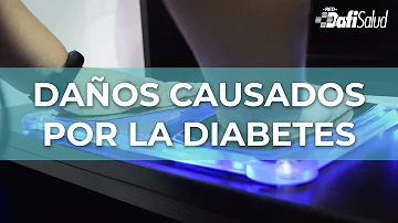 ¿Qué 3 órganos se ven afectados por la diabetes?