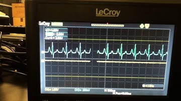 ECG Signal through Differential Amplifier