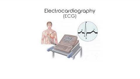 ECG digitization Video