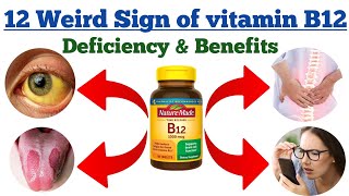 Vitamin B12 benefits and 12 weird sign of vitamin B12 deficiency