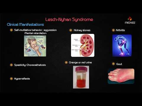 Lesch-Nyhan syndrome - Usmle step 1 Biochemistry Case Based discussion