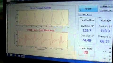 Measuring blood pressure on the radial artery with the TLT Sapphire sensor (M)