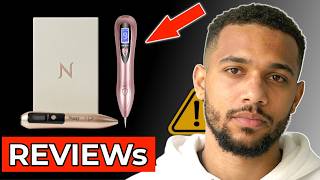 Nuzzy Pen Review 2026 - Does It Actually Work
