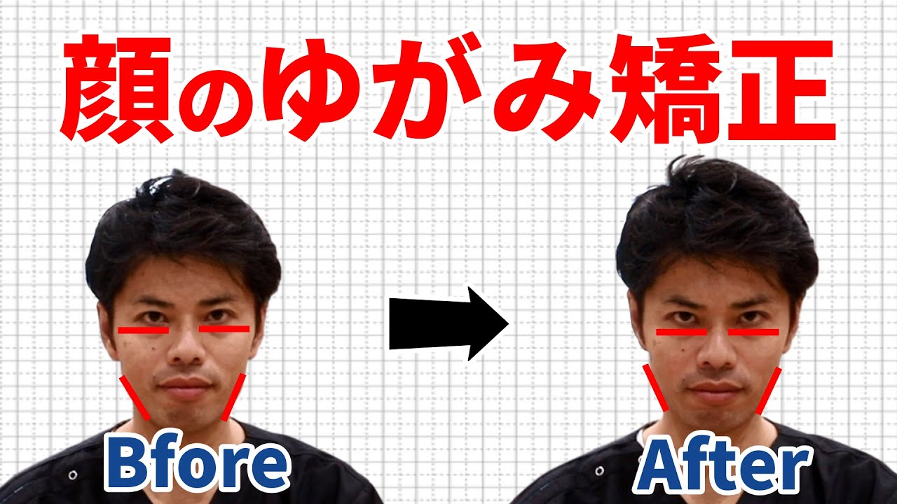 顔のゆがみを矯正して体の歪みを整える方法 東京整体サロン Youtube