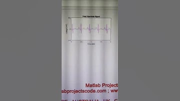 Fetal ECG Extraction Simulink model - FECG - Fetal ECG - ECG -MATLAB SIMULINK