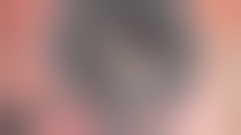 UT DSAEK - Dr. J. Beltz Australia & Dr. N. Soni CBm - double pass technique - MORIA - EN