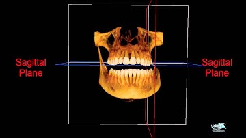 Axial Sagittal & Coronal planes of a CBCT scan