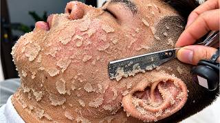 ASMR 🧏‍♀️ FOR A GOOD SLEEP | SATISFYING CLOSE SHAVE & DEAD SKIN REMOVAL SESSION | GENTLE FACE CARE