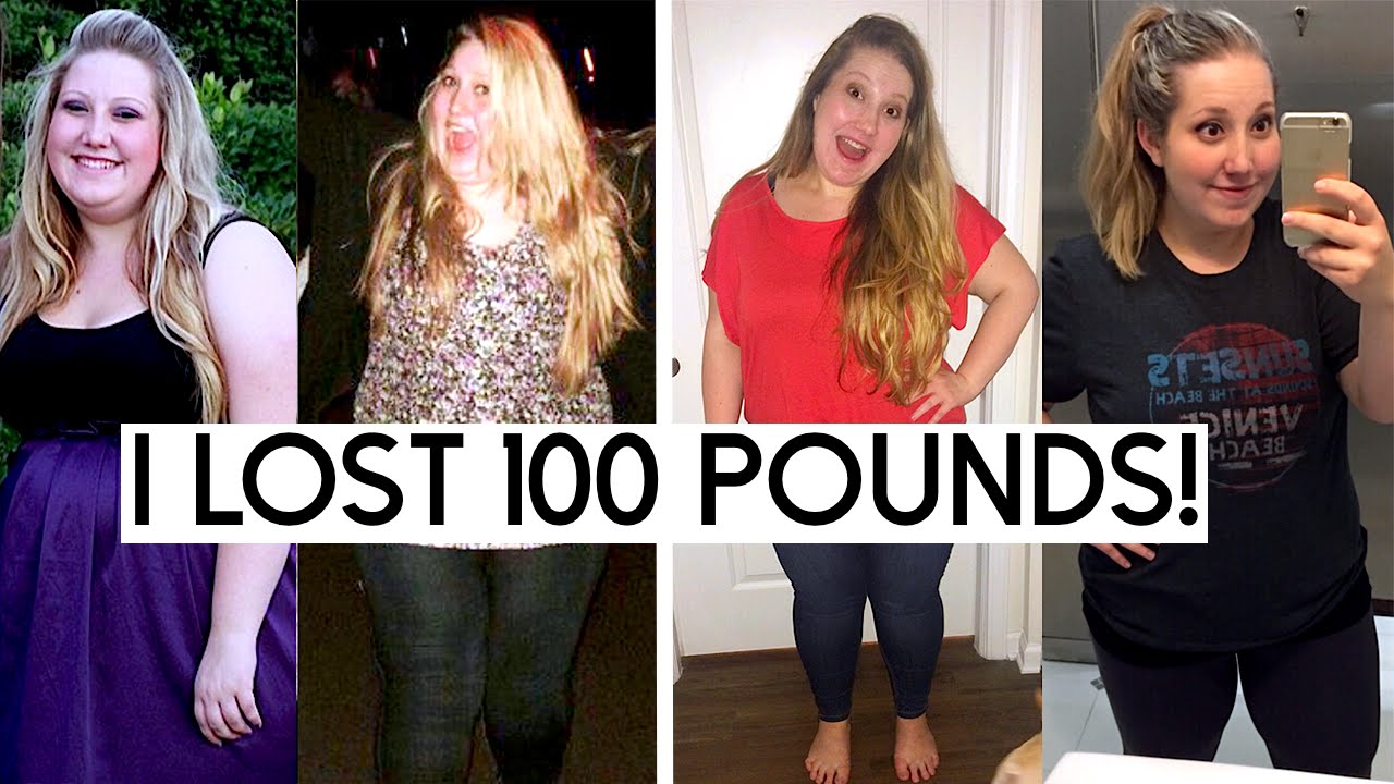 VSG Surgery Update I Lost 100 Pounds Hair Loss Frustrations