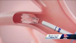 Hospital offering new treatment for people living with COPD screenshot 4