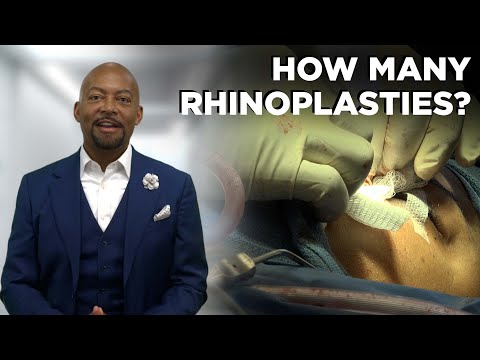 Doctor Jones is a rhinoplasty expert