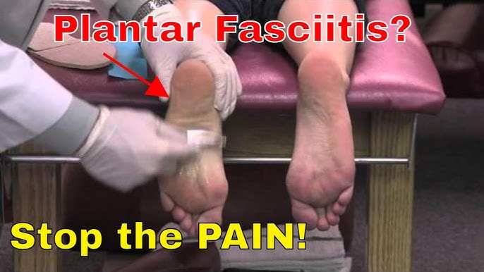 Night Splint for Plantar Fasciitis How to Properly Use it! 