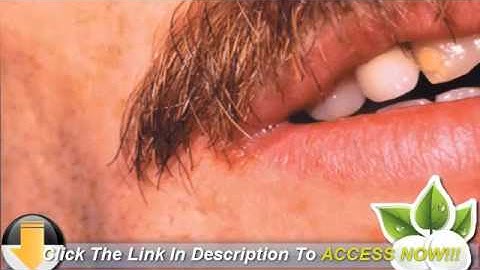Angular Cheilitis Treatment - Overnight Healing For Cracked Lip Corners
