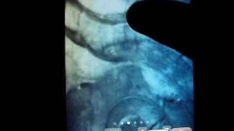 Top 5 Winterboard Themes for iPod Touch/iPhone