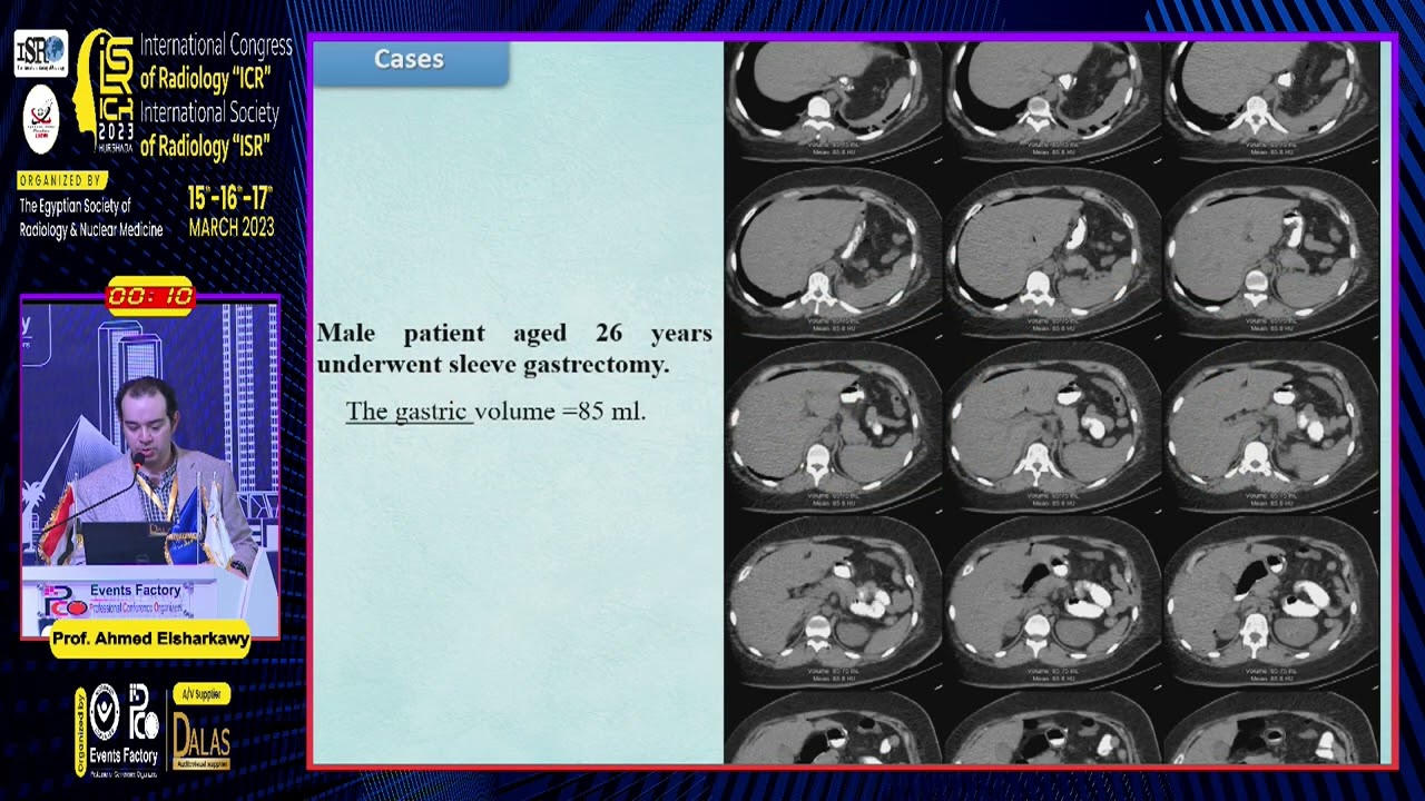 Effectiveness of Left Lateral Oblique Position Gastric Volumetry
