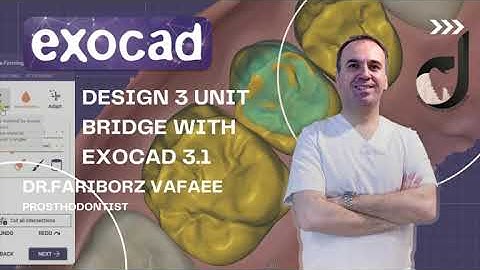 how to design 3 unit bridge with exocad3.1(part4)