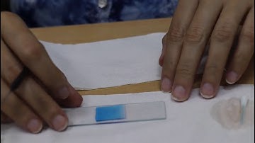 Standard 7: Lesson 11: Cell structure and microorganisms: Part 1 of 4