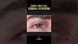#안검하수 자가진단법 #shorts