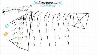 Ultraschall - Sonographie