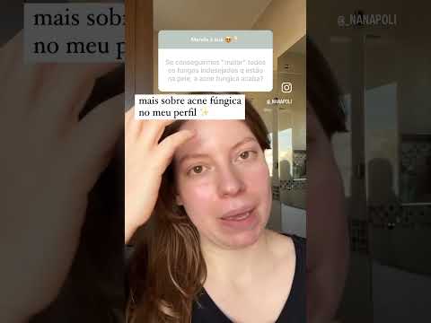 Vídeo: 4 maneiras de evitar acne fúngica