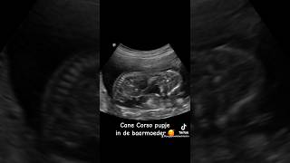 Hoe Mooi Is Deze Echo Van Een Zwangere Hond? Prachtig Pupje In De 7E Week Van De Zwangerschap