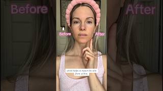 ZIIP HALO MICROCURRENT DEVICE TUTORIAL | AT HOME FACE LIFT #skincare #skinhacks #antiagingskincare