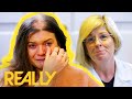“Easy To Feel Unlovable” Girl Who Pulls Her Hair Suffers From Large Bald Spot | The Hair Loss Clinic