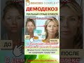 ДЕМОДЕКОЗ. Отзыв: 🚫 ПОЧЕМУ Я ОТКАЗАЛАСЬ ОТ ЛЕЧЕНИЯ У ДЕРМАТОЛОГА! Продолжение истории с демодексом🔍