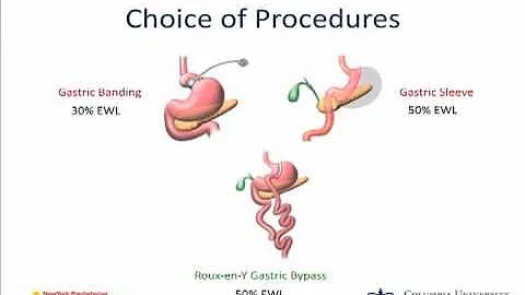Obesity Surgery in Teens
