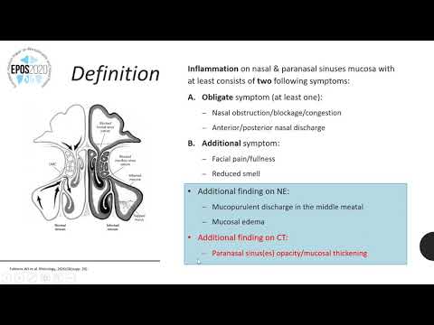 Diagnosis & Management of Acute Rhinosinusitis