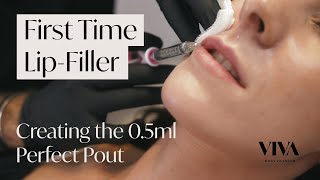 Getting Lip Fillers for the First Time 🧪  Everything You Need to Know about Lip Fillers