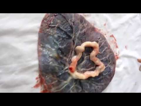Vídeo: A placenta tem pulso?