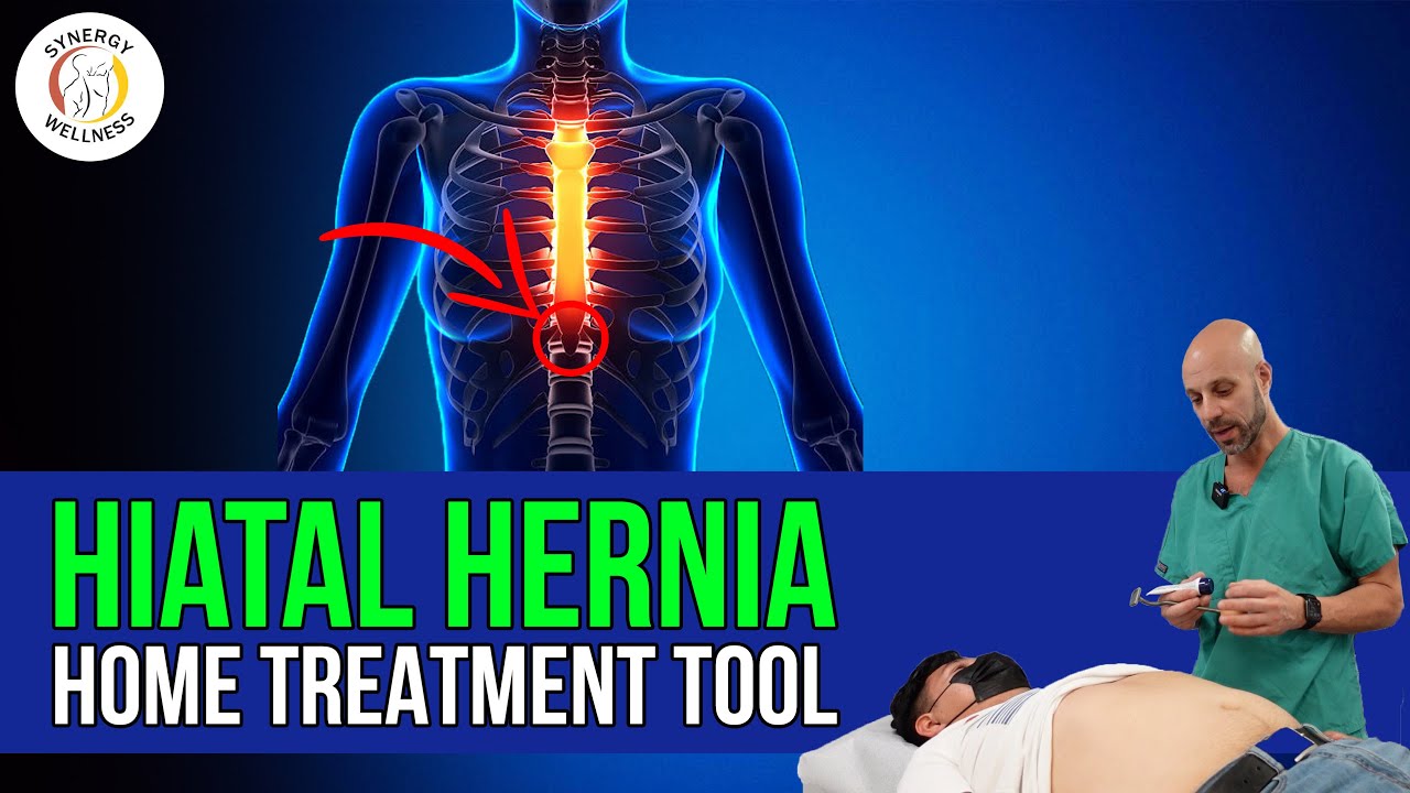 Hiatal Hernia Home Treatment Tool Youtube