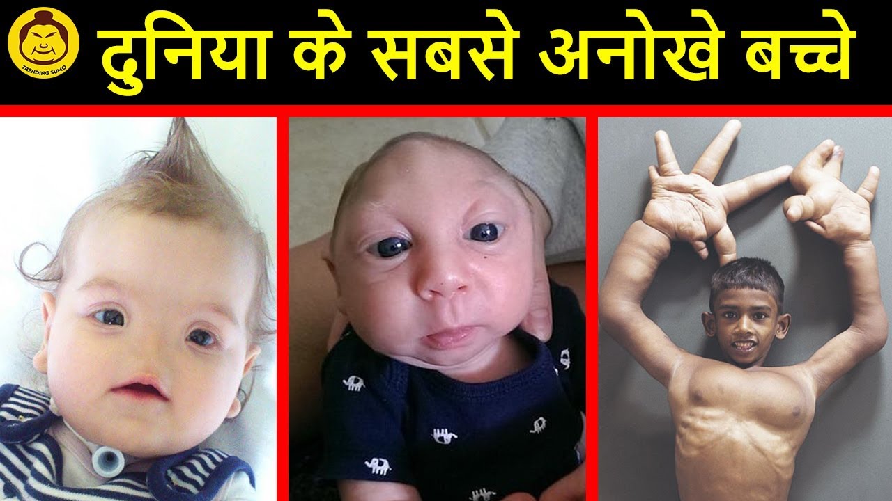 TOP MOST UNUSUAL KIDS IN THE WORLD Kids You Won't Believe Exist YouTube