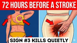 SENIORS: 7 Mini-Stroke (TIA) Warning Signs (Everyone Misses #3 Until It's Too Late)