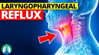 Laryngopharyngeal Reflux (Medical Definition) | Quick Explainer Video