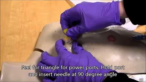 Accessing Implanted Ports