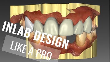 Design Outsource: InLab Anterior Case Instruction