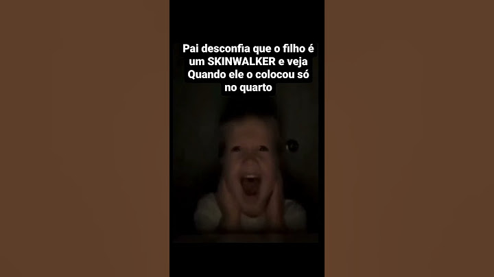 🔴 Criança Skinwalker! #shorts