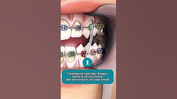 What happens if you aren