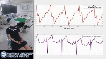 Noncontact Cardiac Monitoring Using an IR UWB Radar Sensor, August 2016.